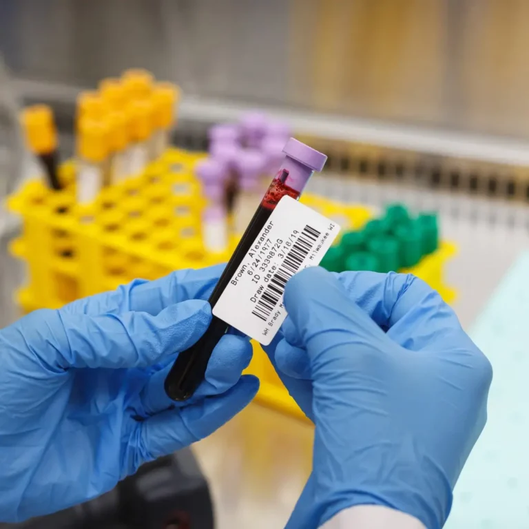 Test Tube Sample Labels